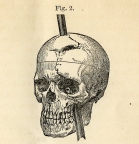 phineas gage's Avatar